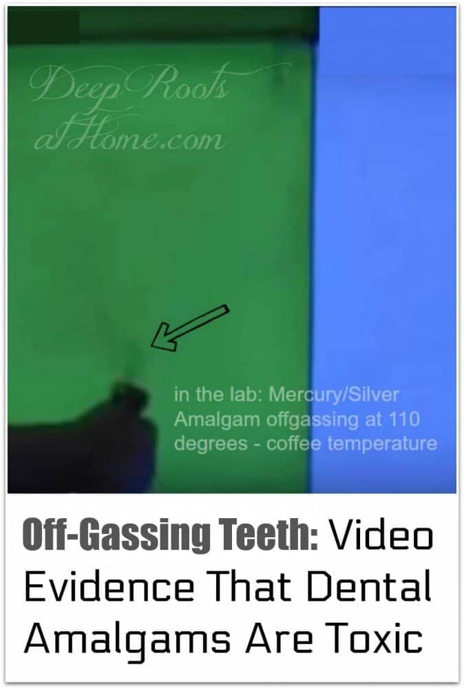 OffGassing Teeth Video Evidence Dental Amalgams Are Toxic